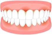 gingivite soins jet dentaire ozone aquolab hygiene-precision
