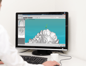 CBCT guided implant treatment planning