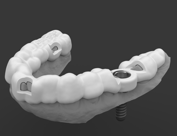 Dental Implant Surgical guide / Template