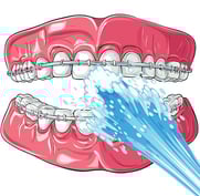 jet dentaire ozone orthodontie aquolab hygiene-precision
