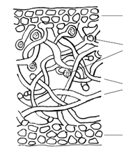 Lichen foliacé