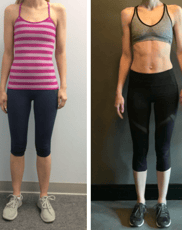 The before and after image of a lady who did a weight loss program