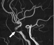 Angiography (DSA)