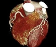 Human Heart