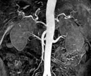 kidney