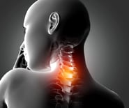 Cervical Spondylosis
