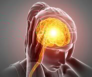 Migraine