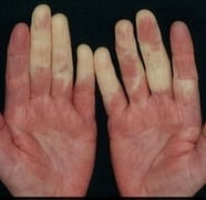 mãos humanas com as pontas dos dedos pálidas