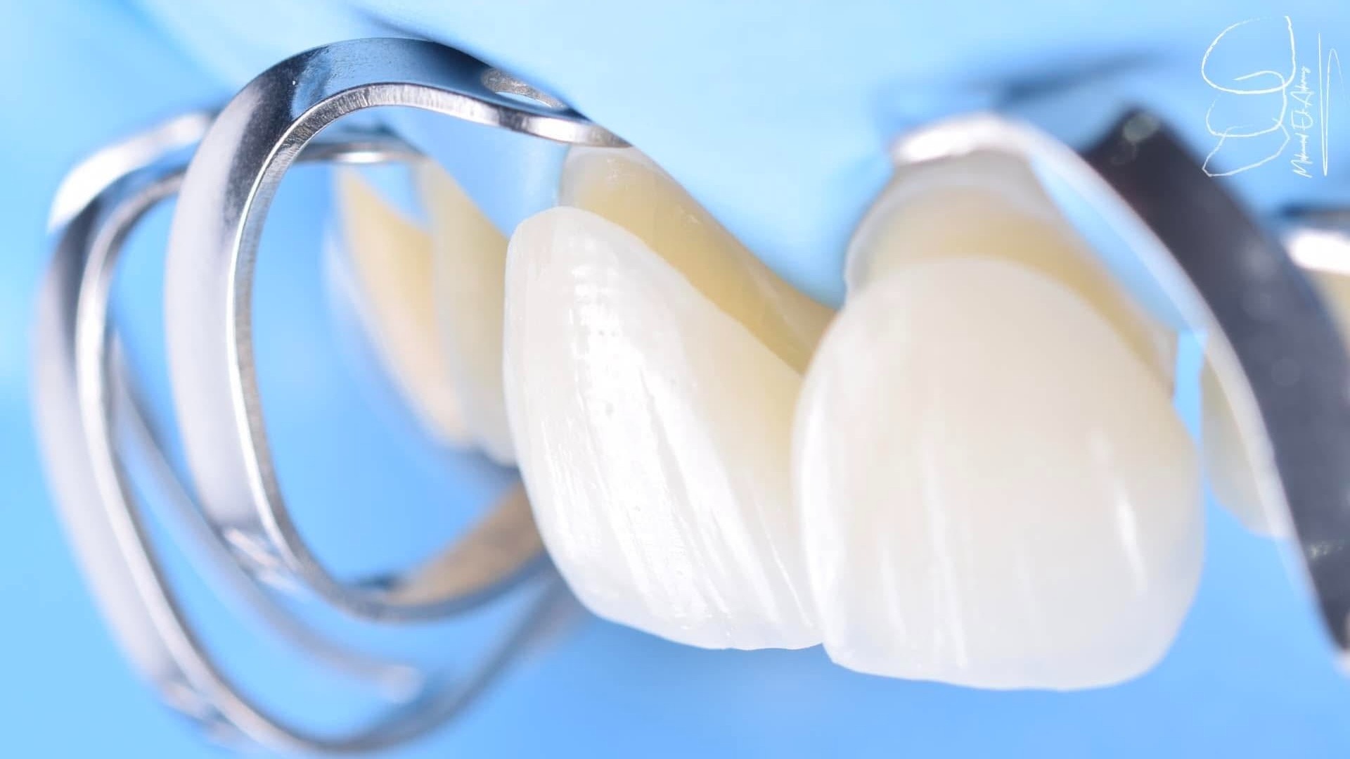 a close up of a woman's mouth with white teeth