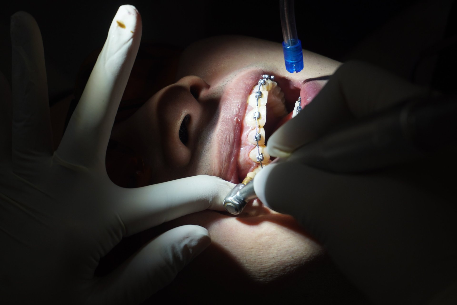 woman wearing yellow long-sleeved dress under white clouds and blue sky during daytime