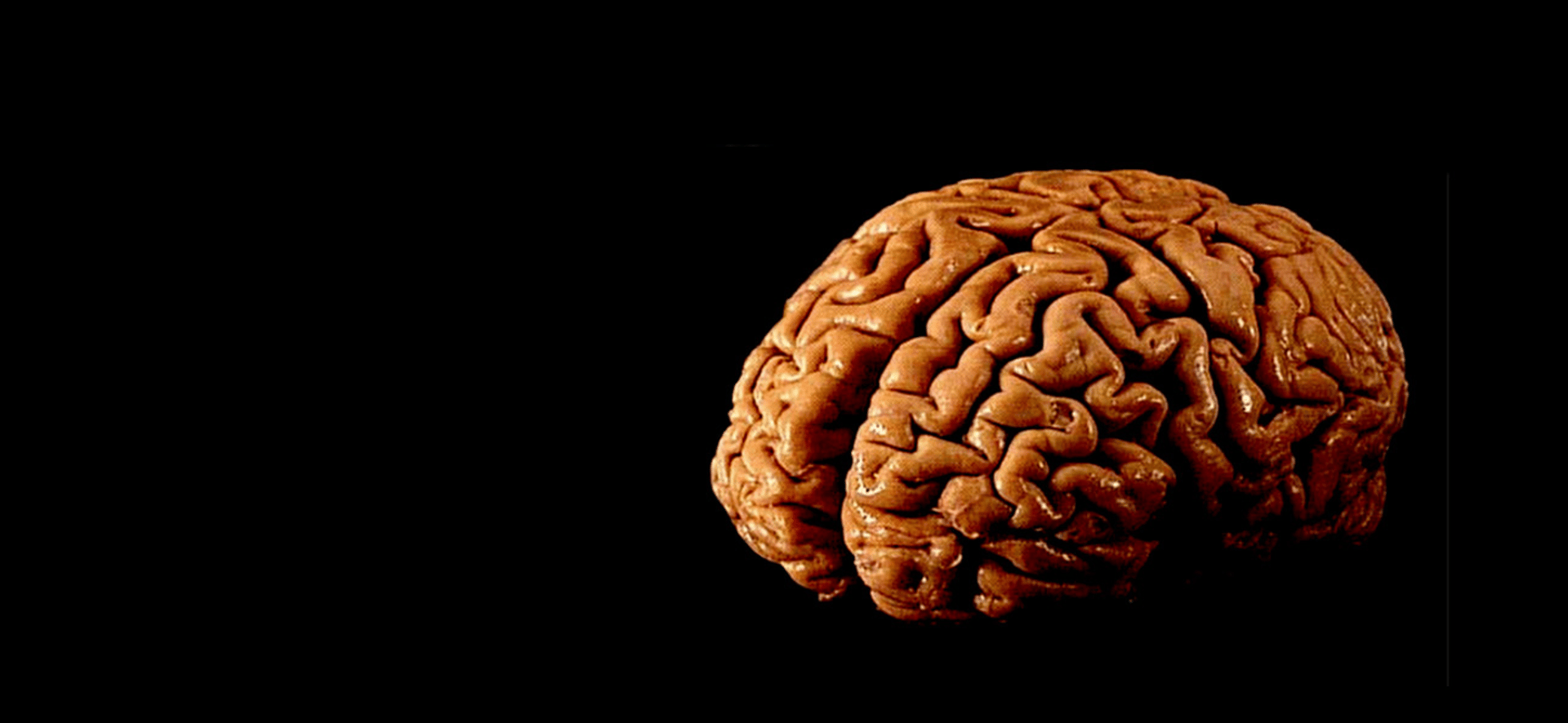 A human brain specimen.
