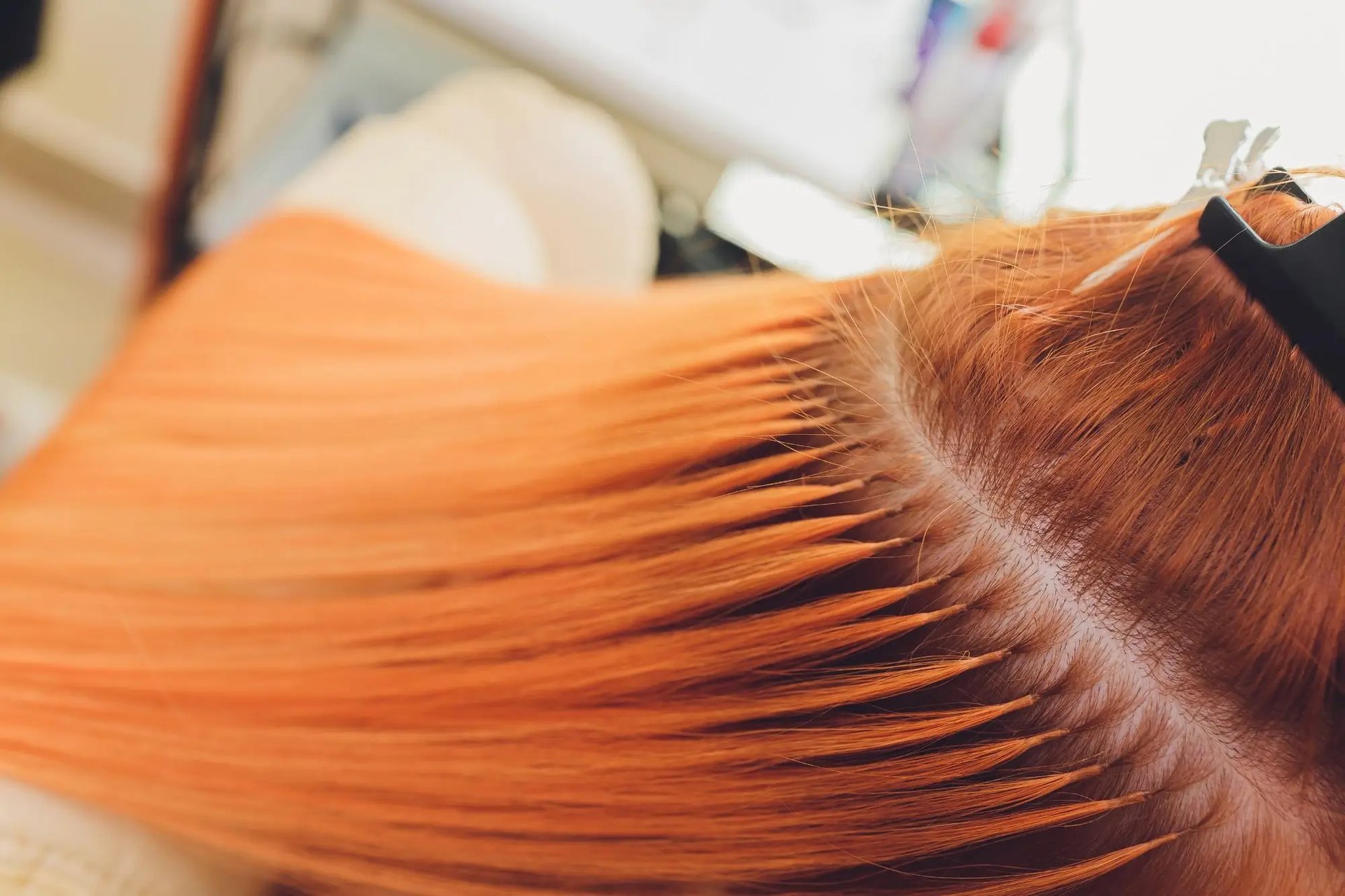 hair loss treatments in hull