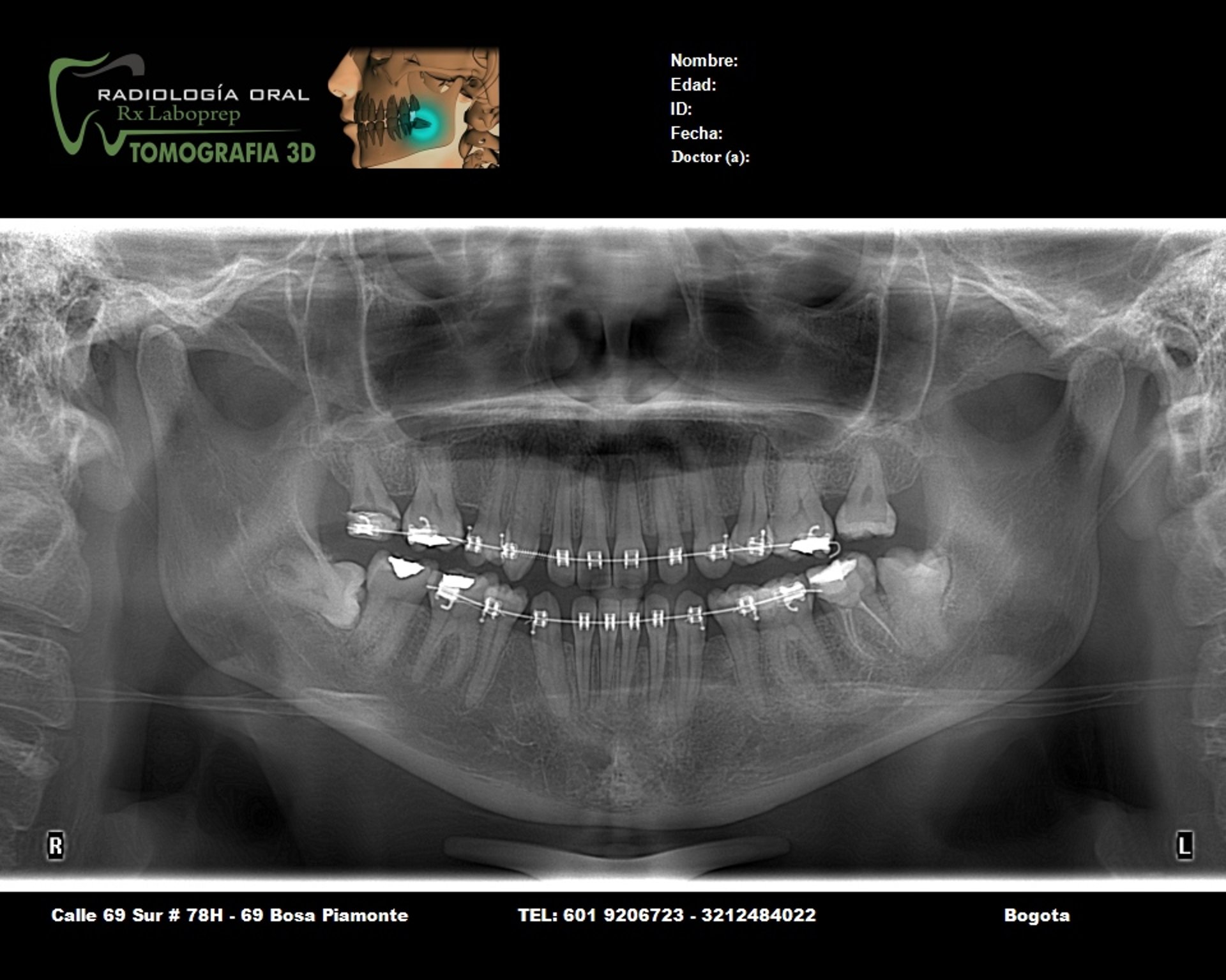 woman wearing yellow long-sleeved dress under white clouds and blue sky during daytime