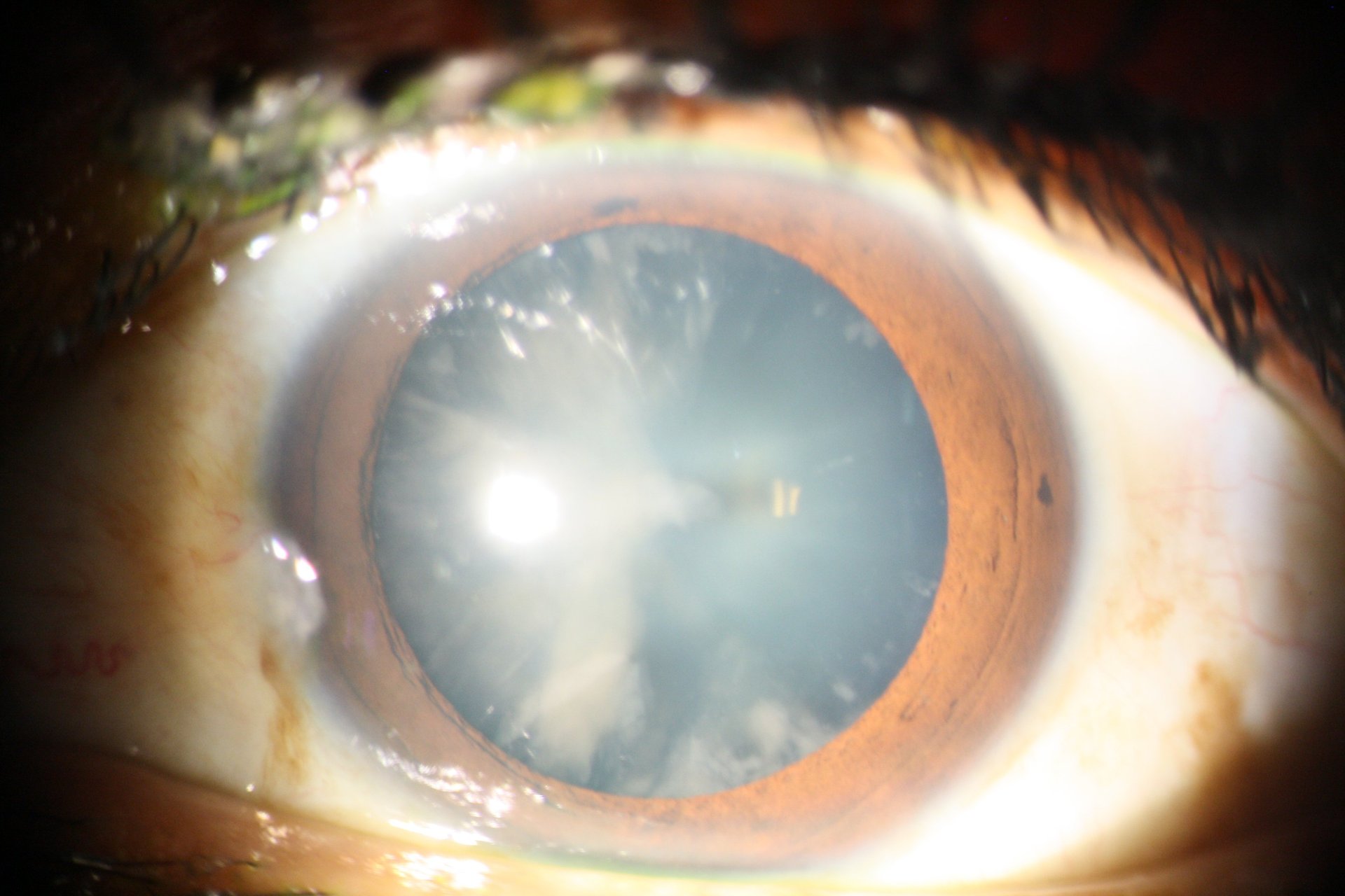 gray computer monitor