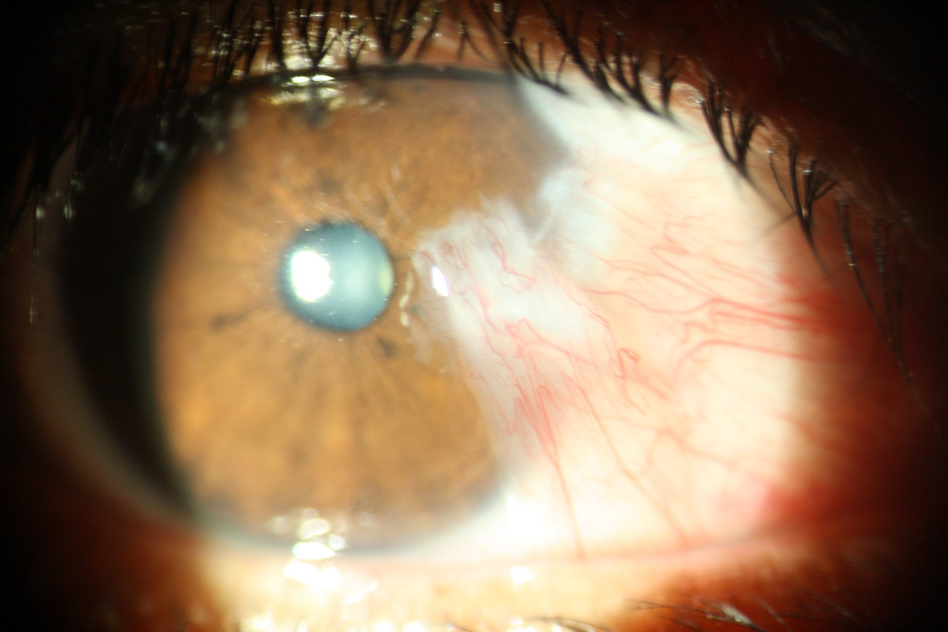 gray computer monitor