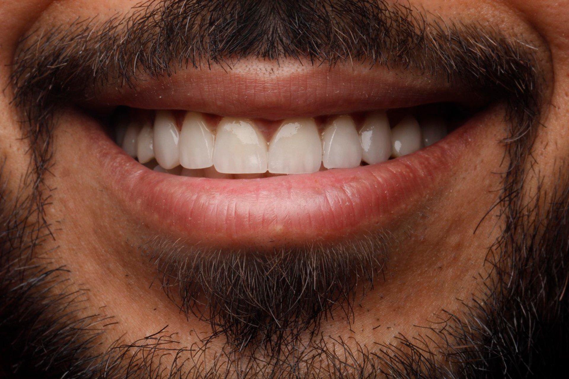 a close-up of a person's mouth with teeth showing
