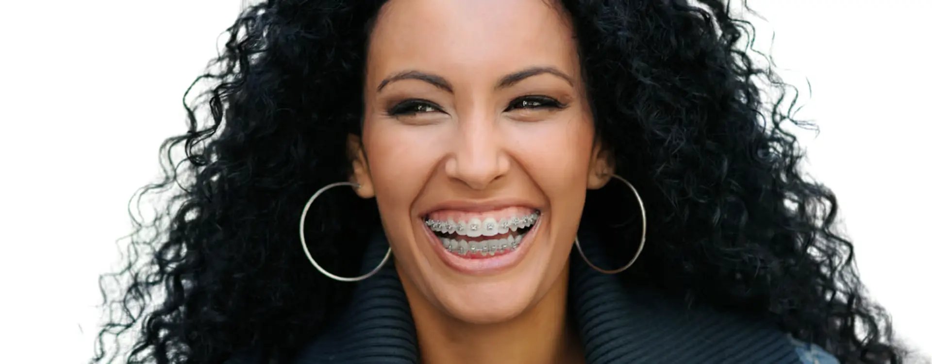 Detalhe de sorriso alinhado durante tratamento ortodôntico com dentista em Palmas.