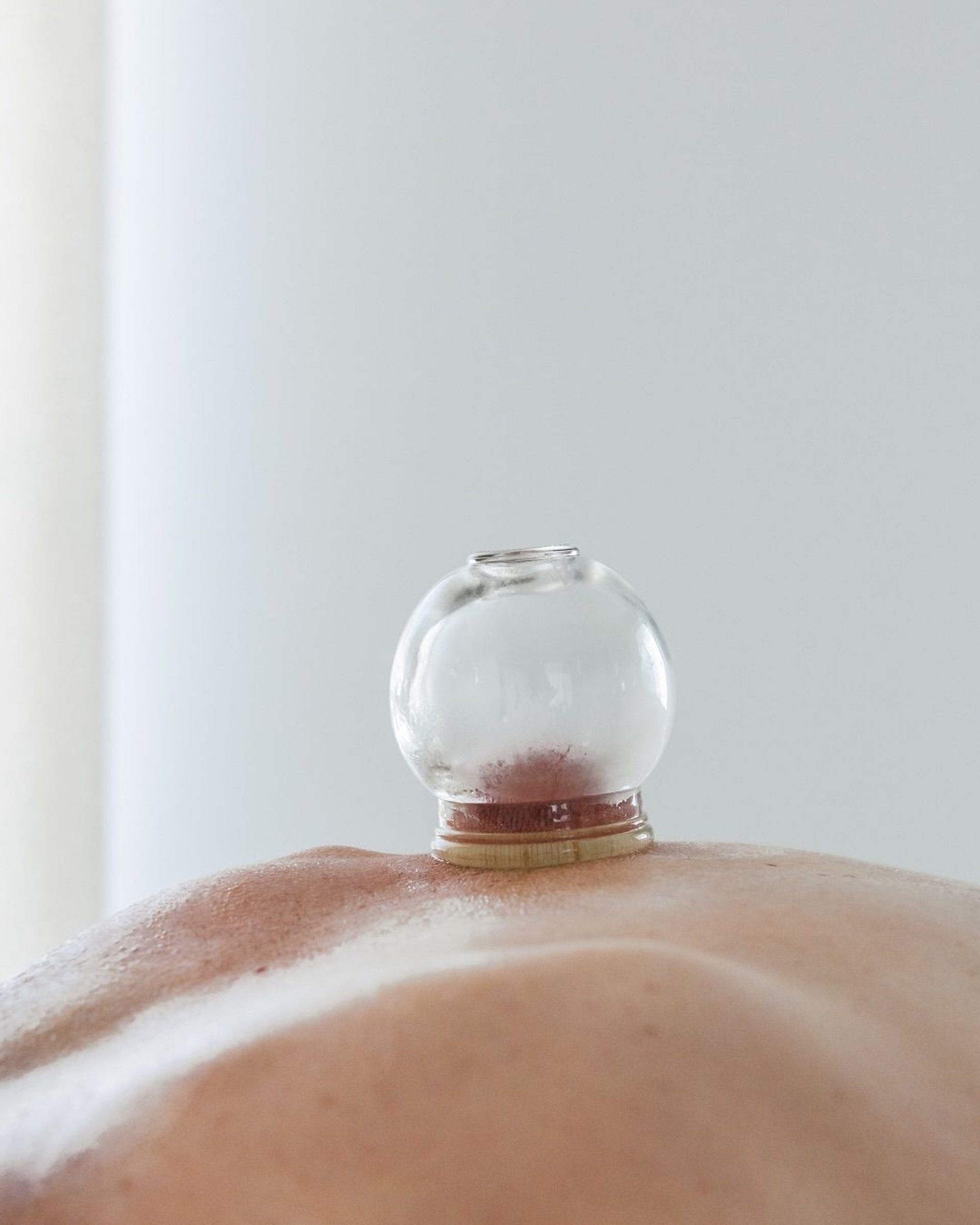 Médecine Traditionnelle Chinoise MTC séance acupuncture cupping therapie ventouse reflexologie plantaire auriculothérapie