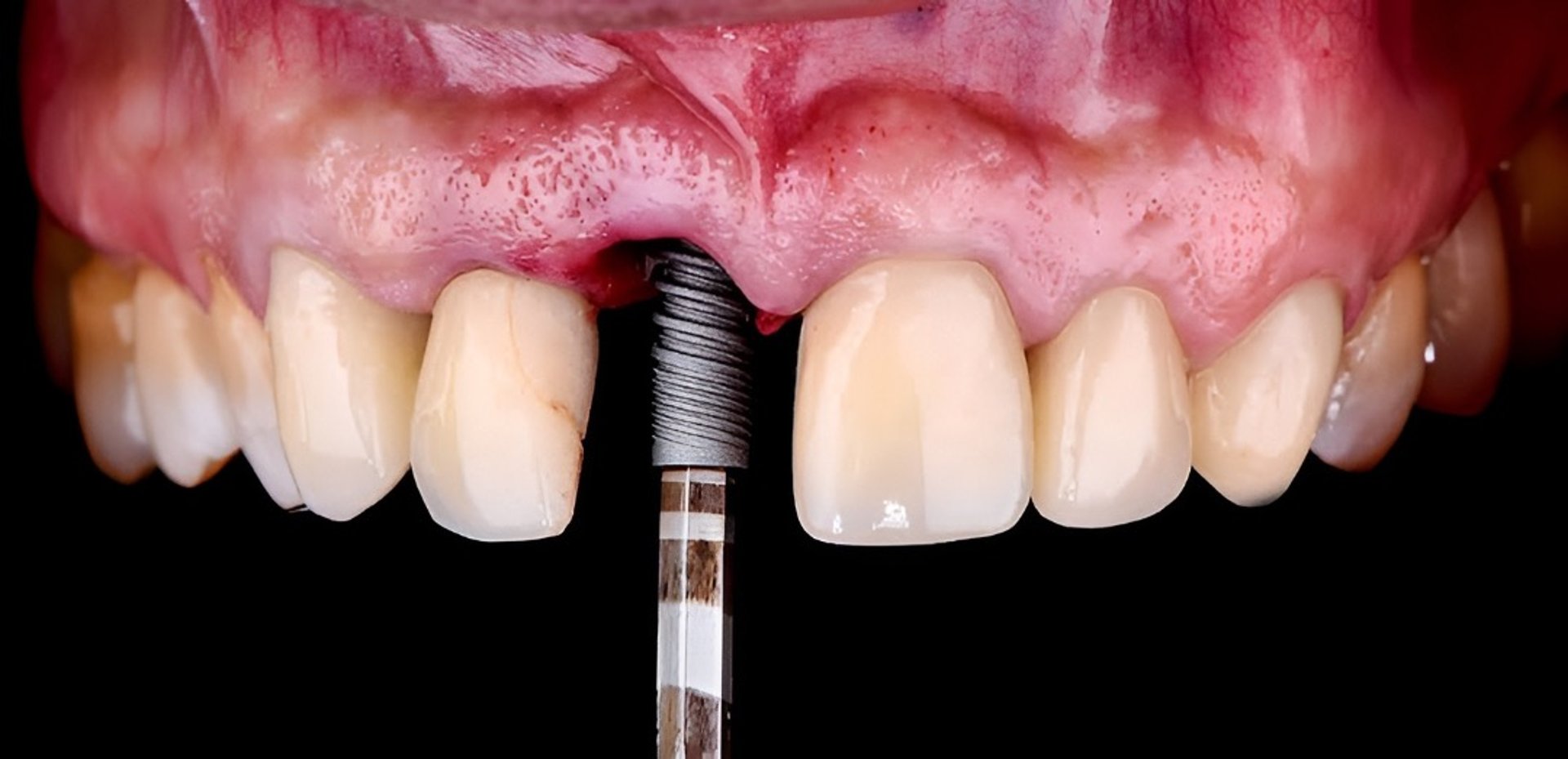 close-up of a person's mouth