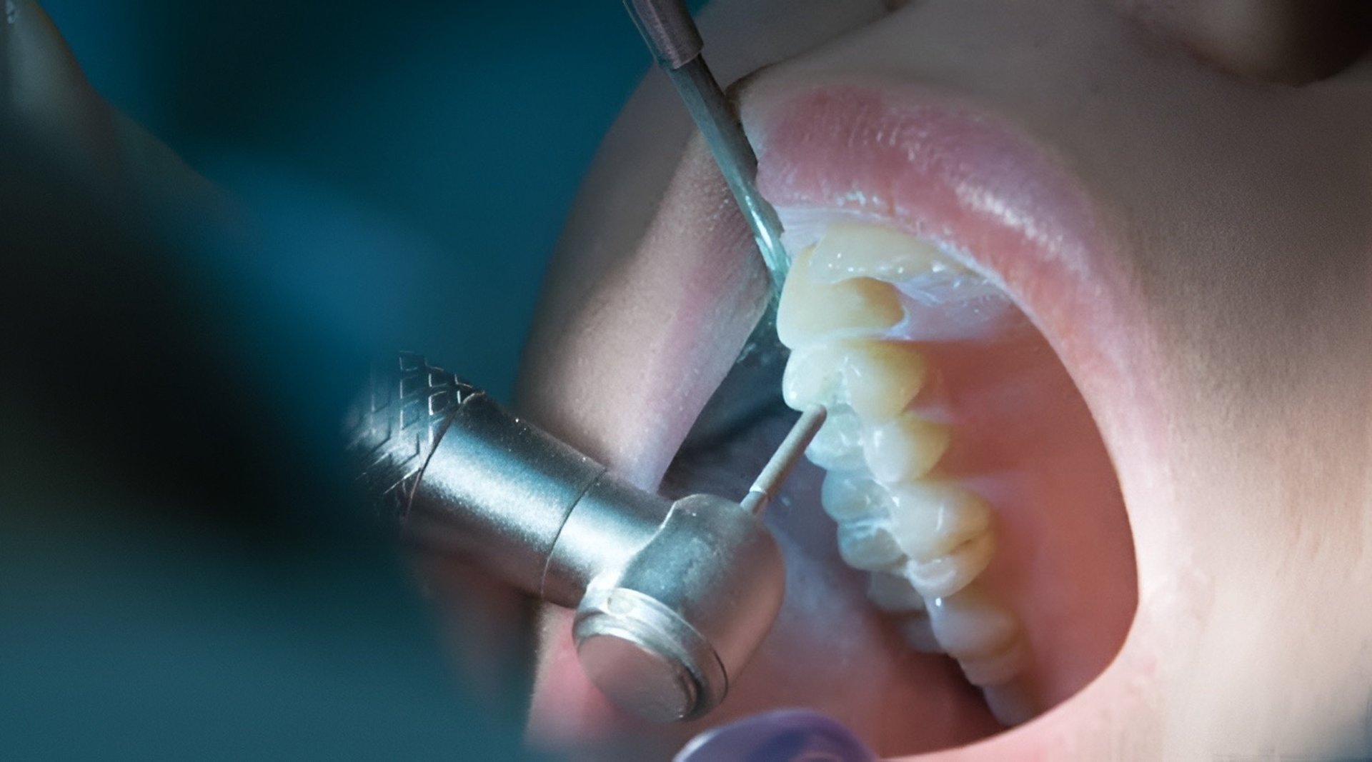 close-up of a person's mouth