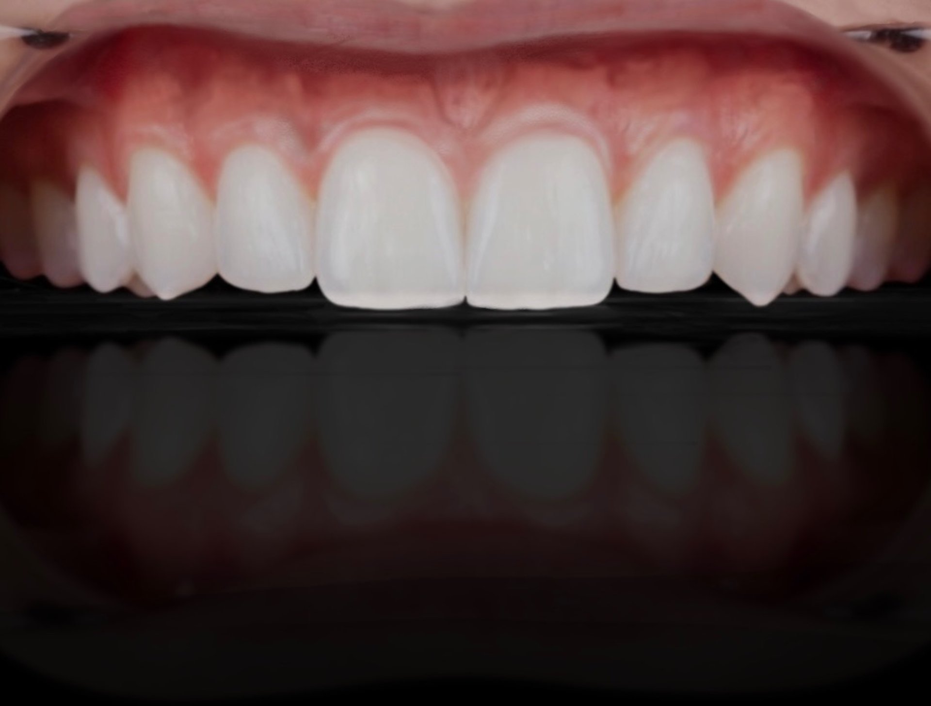 black and white bed linen