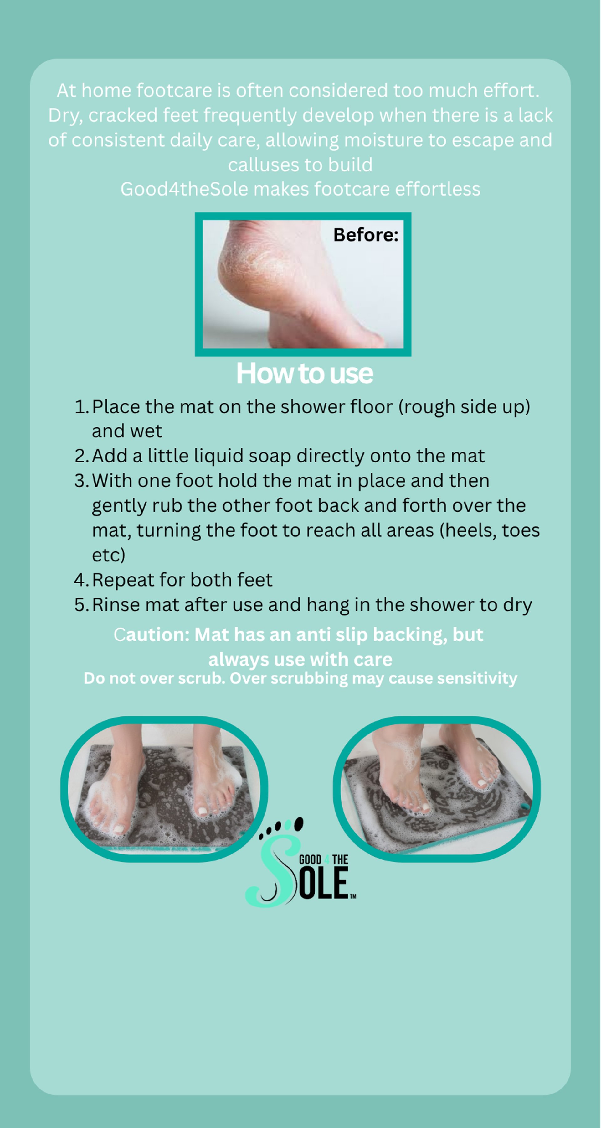 Before cracked heels compared to smooth beautiful feet using exfoliating shower mat