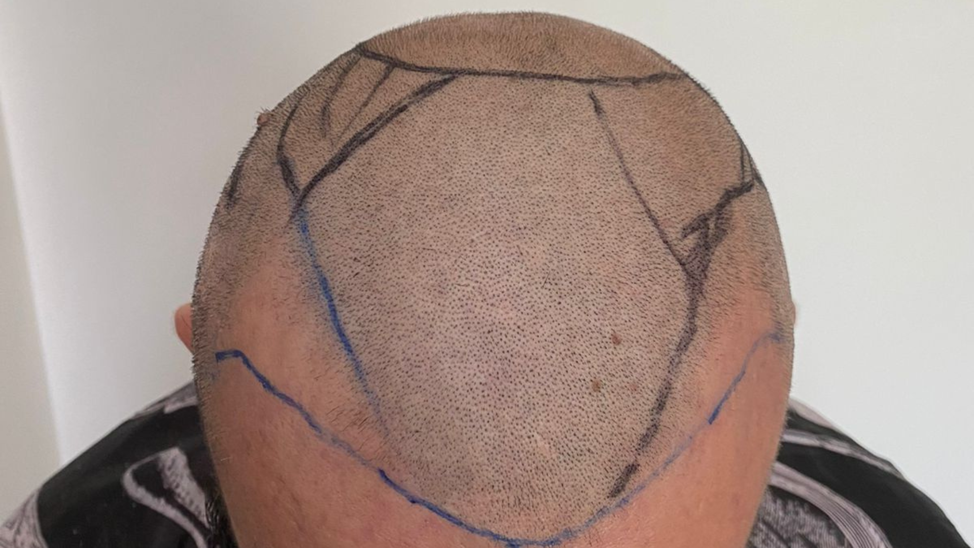 black and white bed linen