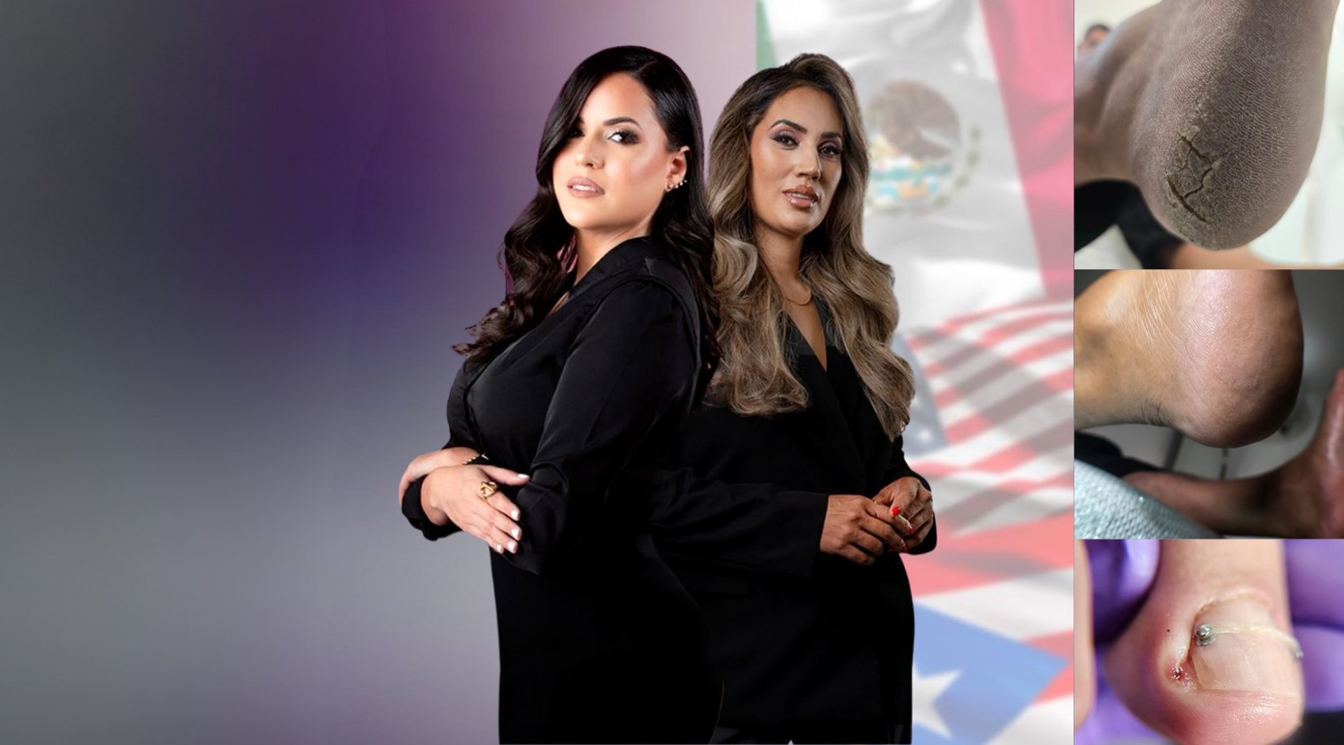 a pair of feet with painted toenails