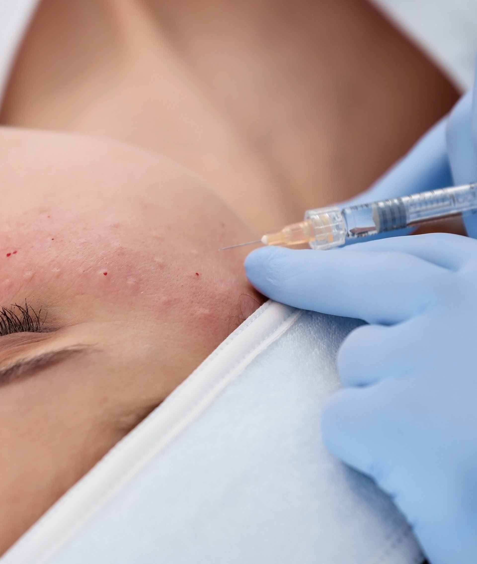 A woman in a hospital gown is getting an injection