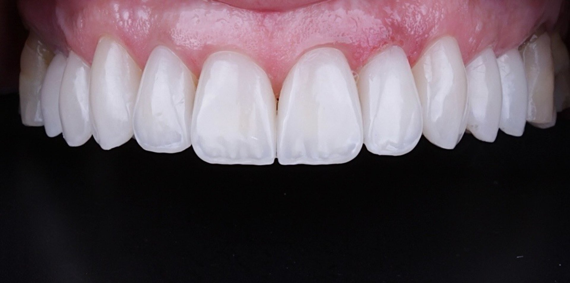 woman wearing yellow long-sleeved dress under white clouds and blue sky during daytime