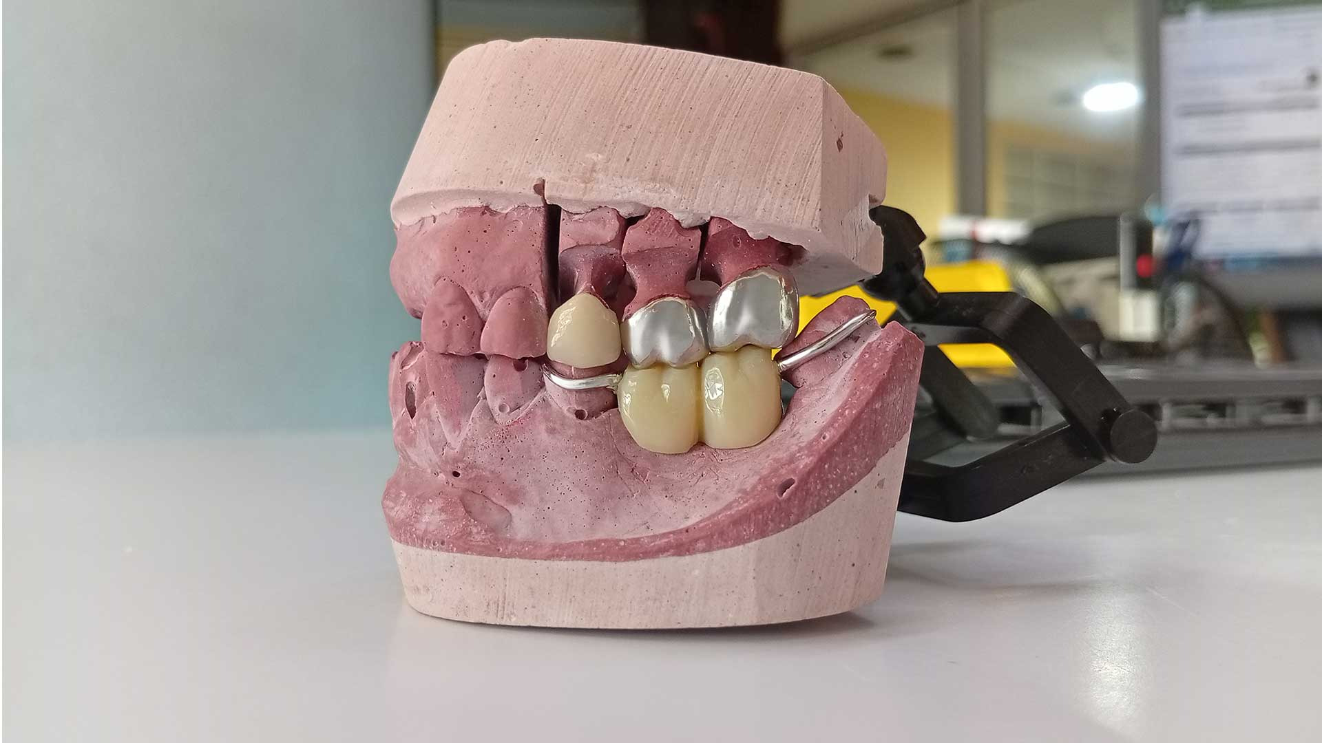 a model of a tooth with a toothbrush in it