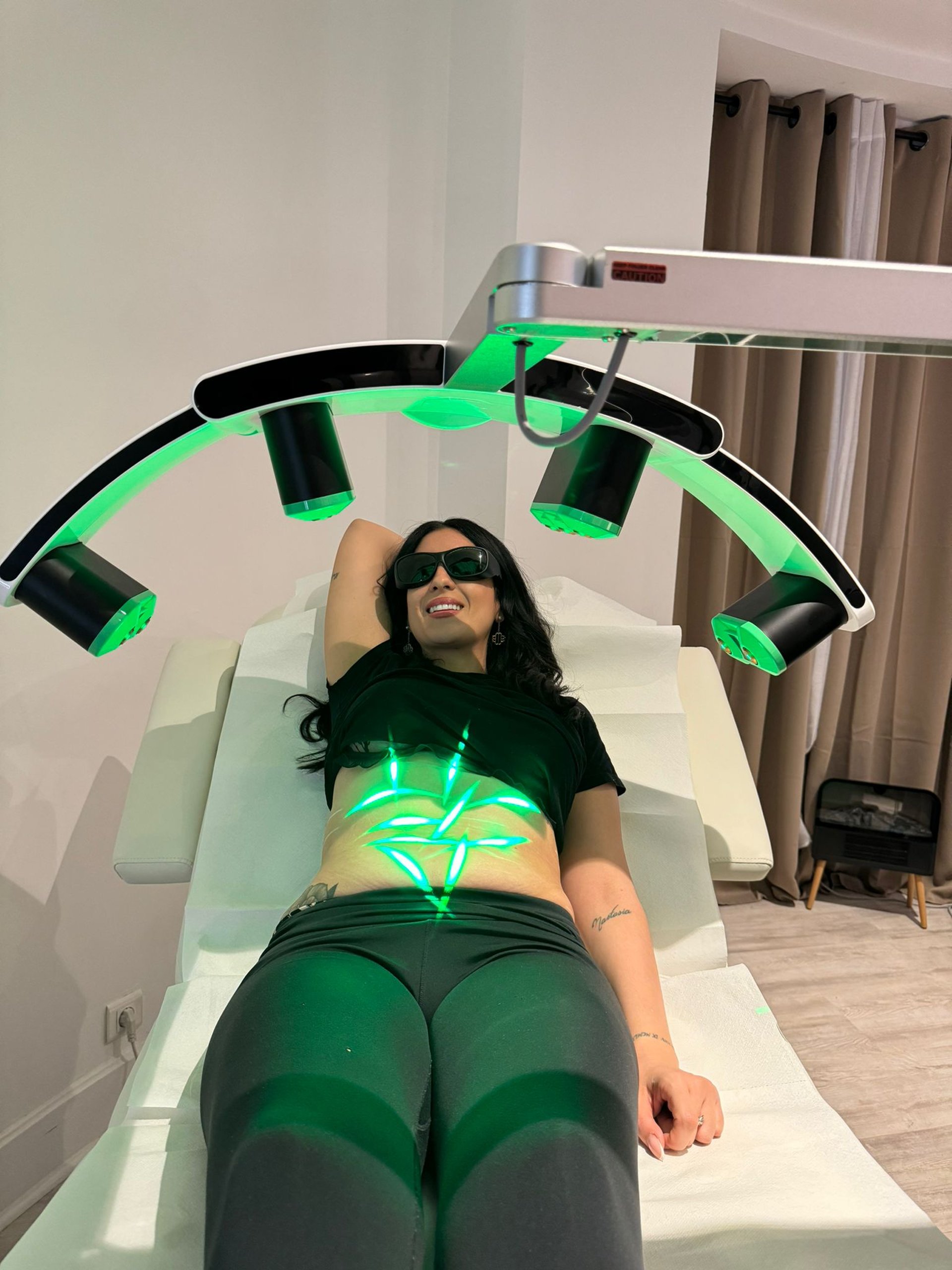 a group of white eggs