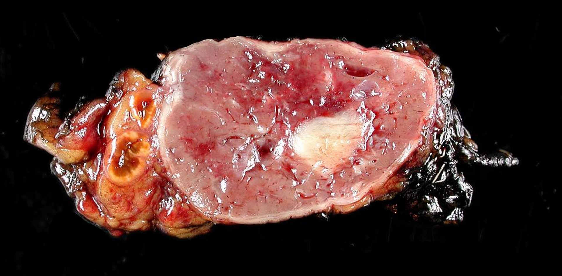 selective focus photography of anatomy lungs