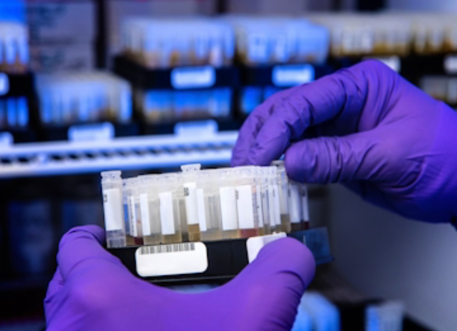 Laboratory technician processing diagnostic blood samples for neurological testing