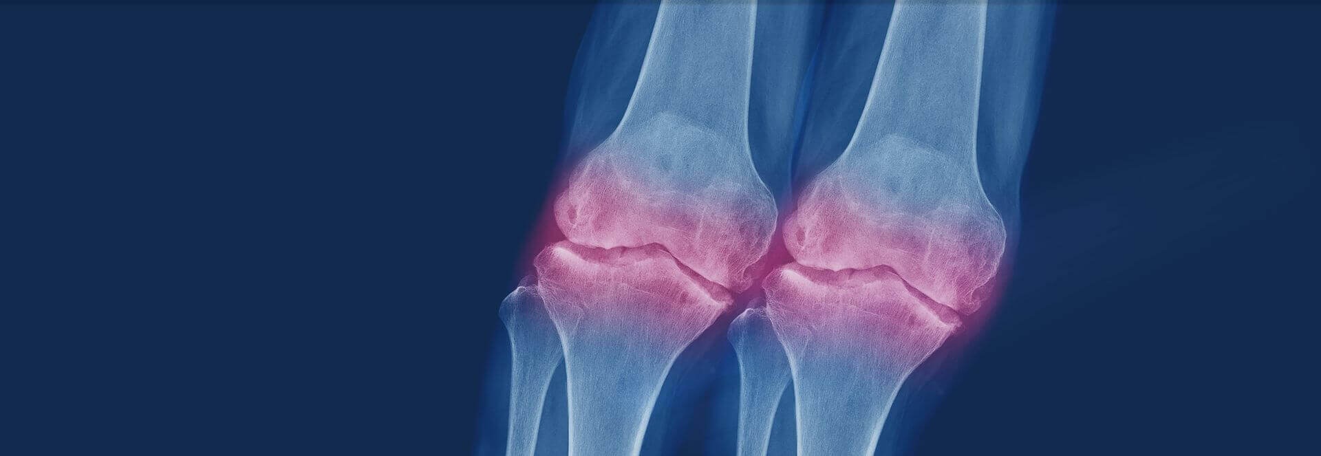 Hintergrundbild mit ArtiZynt Gel – Produktpräsentation mit Rabatt und exklusivem Angebot