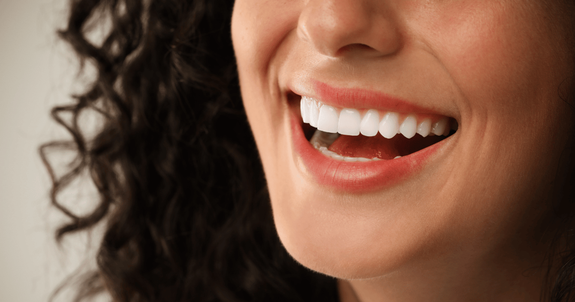 Paciente sorrindo após clareamento dental realizado na clínica odontológica
