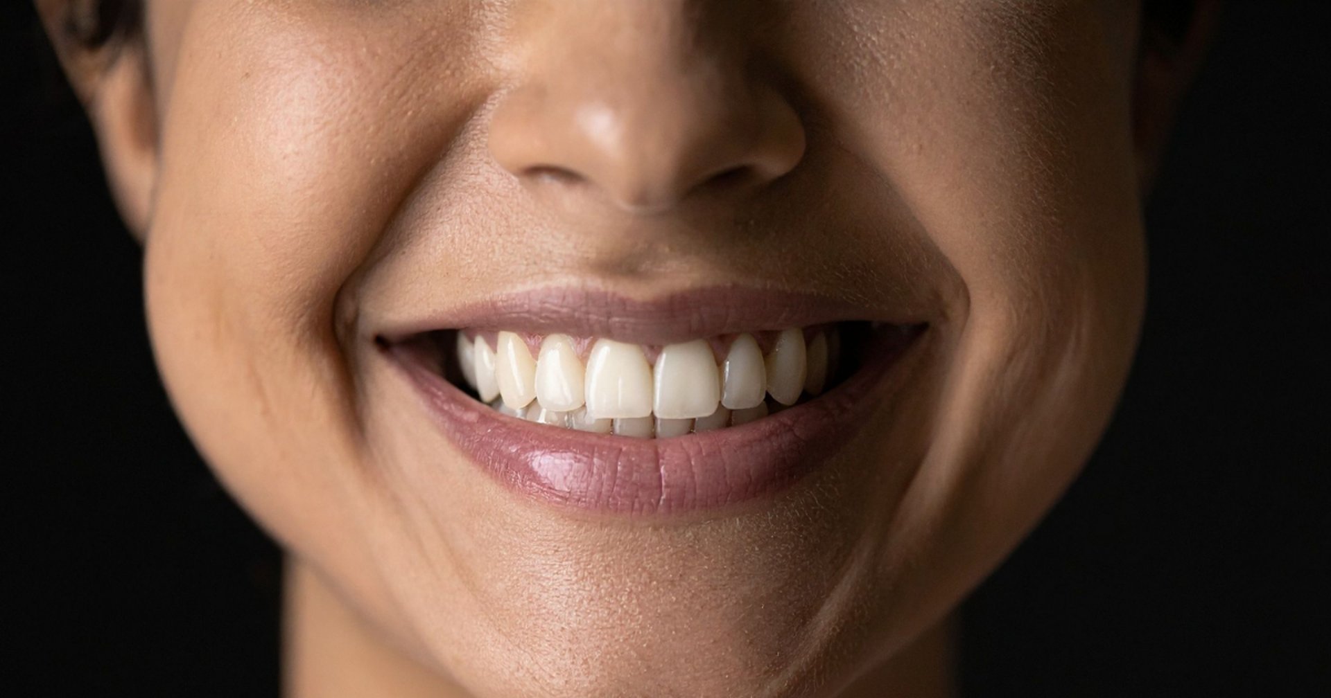 Implante dentário com mulher sorrindo em São Mateus do Sul