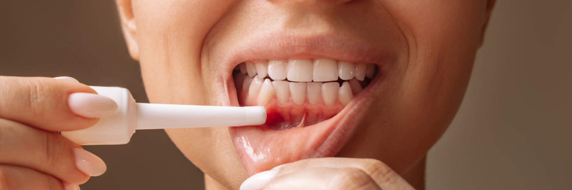 entista realizando tratamento periodontal em paciente com problema gengival