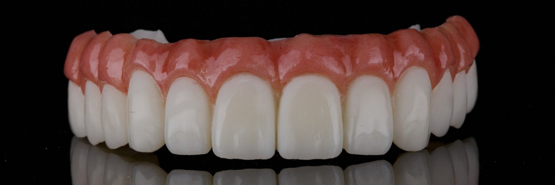 Paciente sorrindo após reabilitação oral com prótese protocolo fixa
