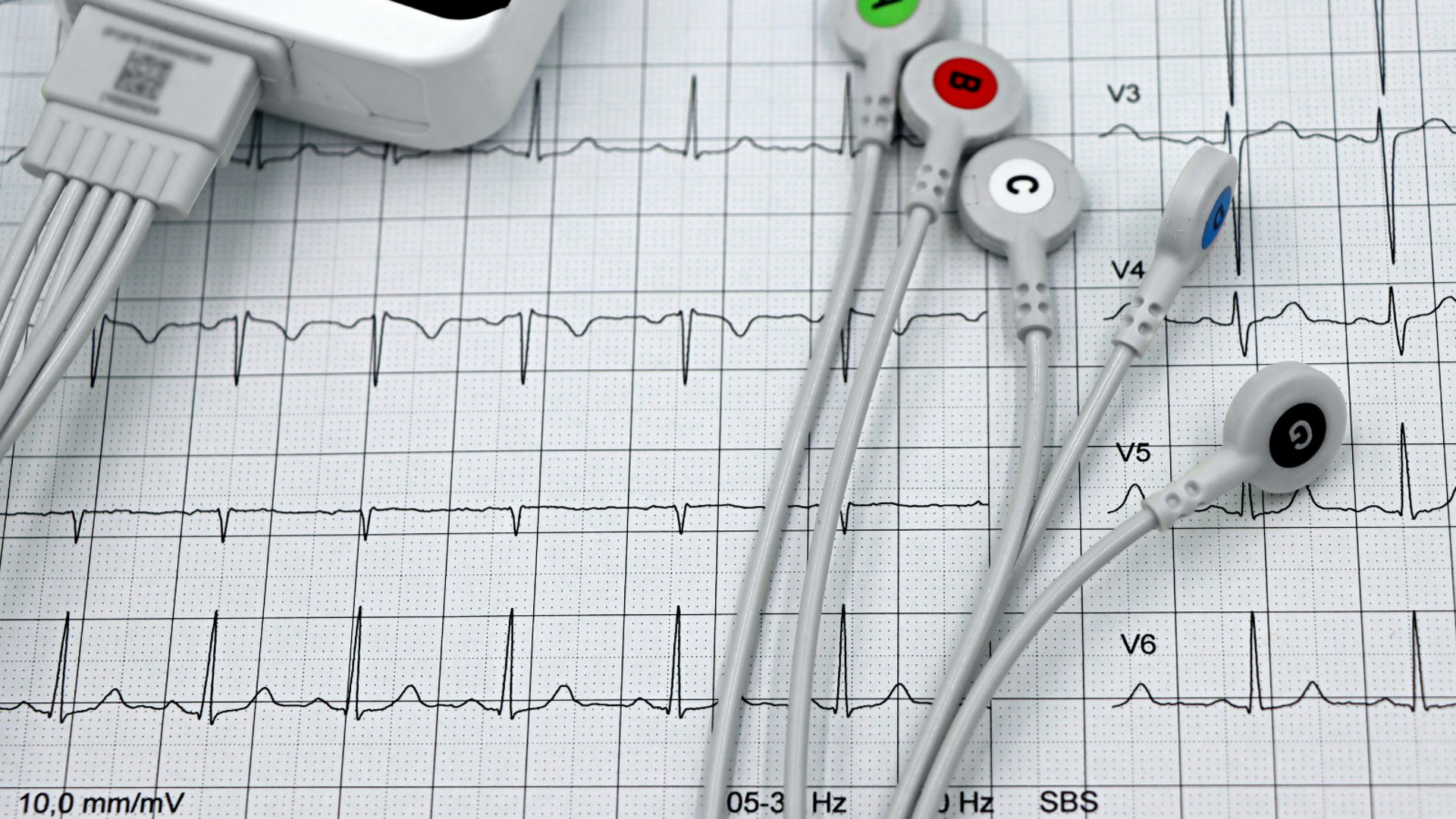 doctor holding red stethoscope
