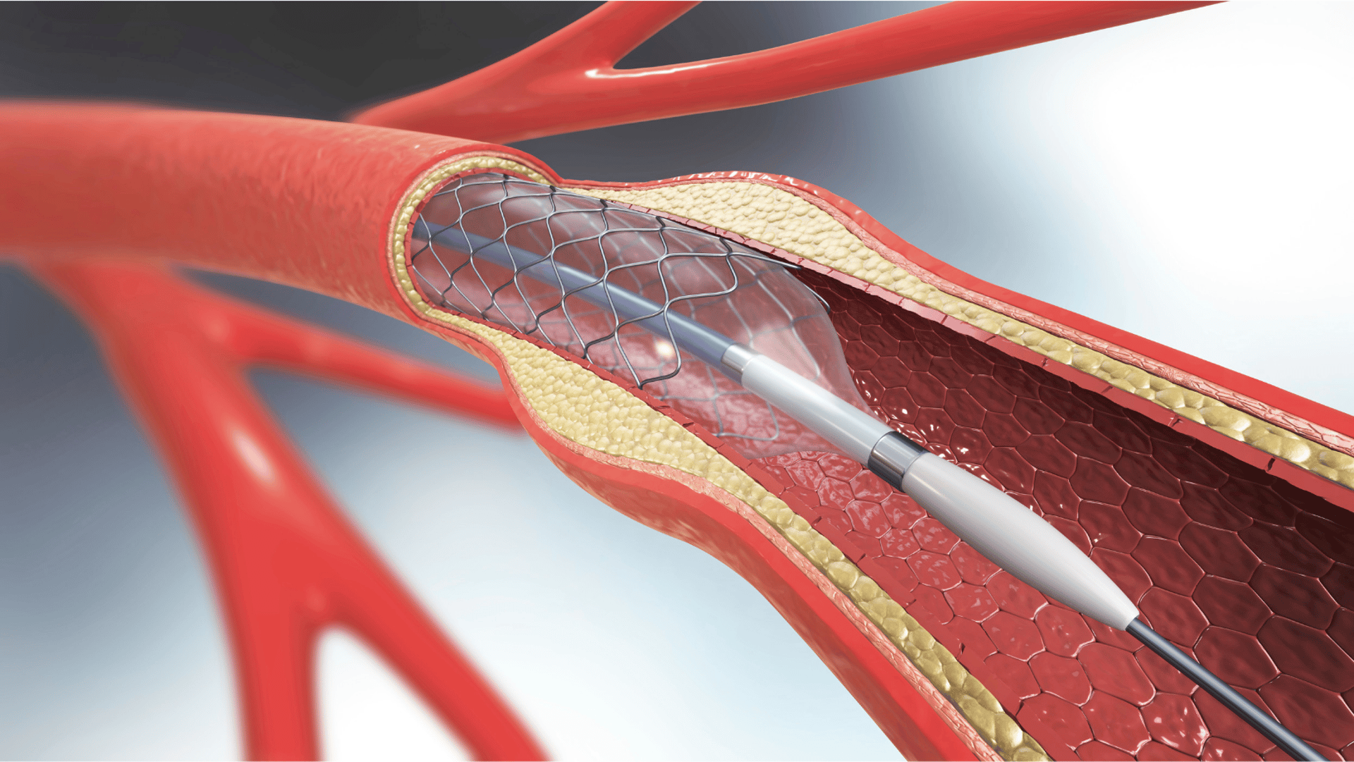 selective focus photography of heart organ illustration