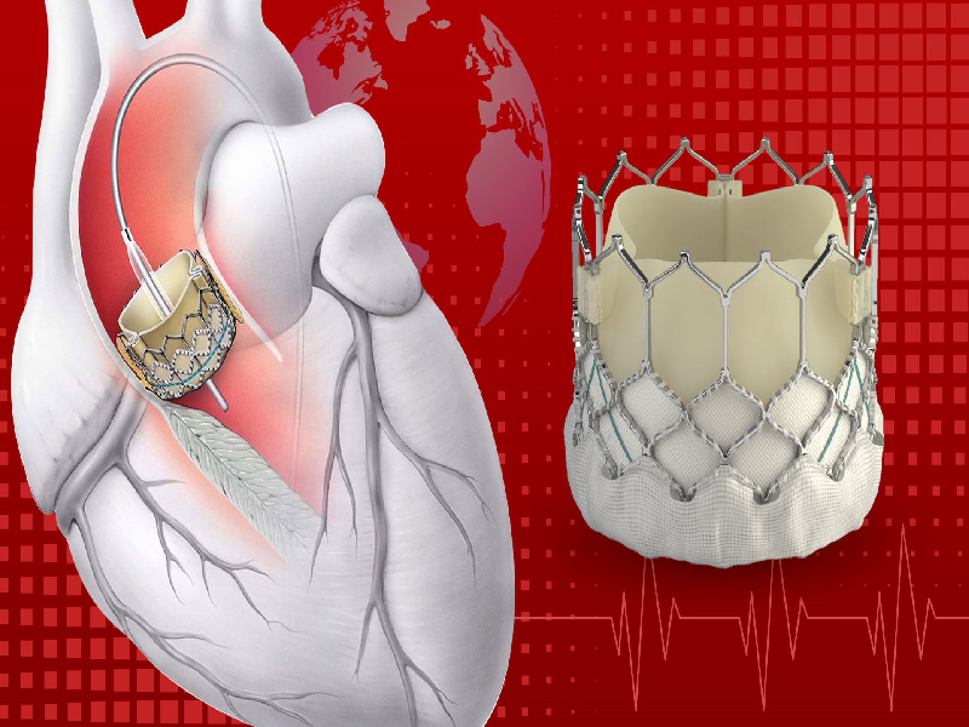 a model of a human heart on a white surface