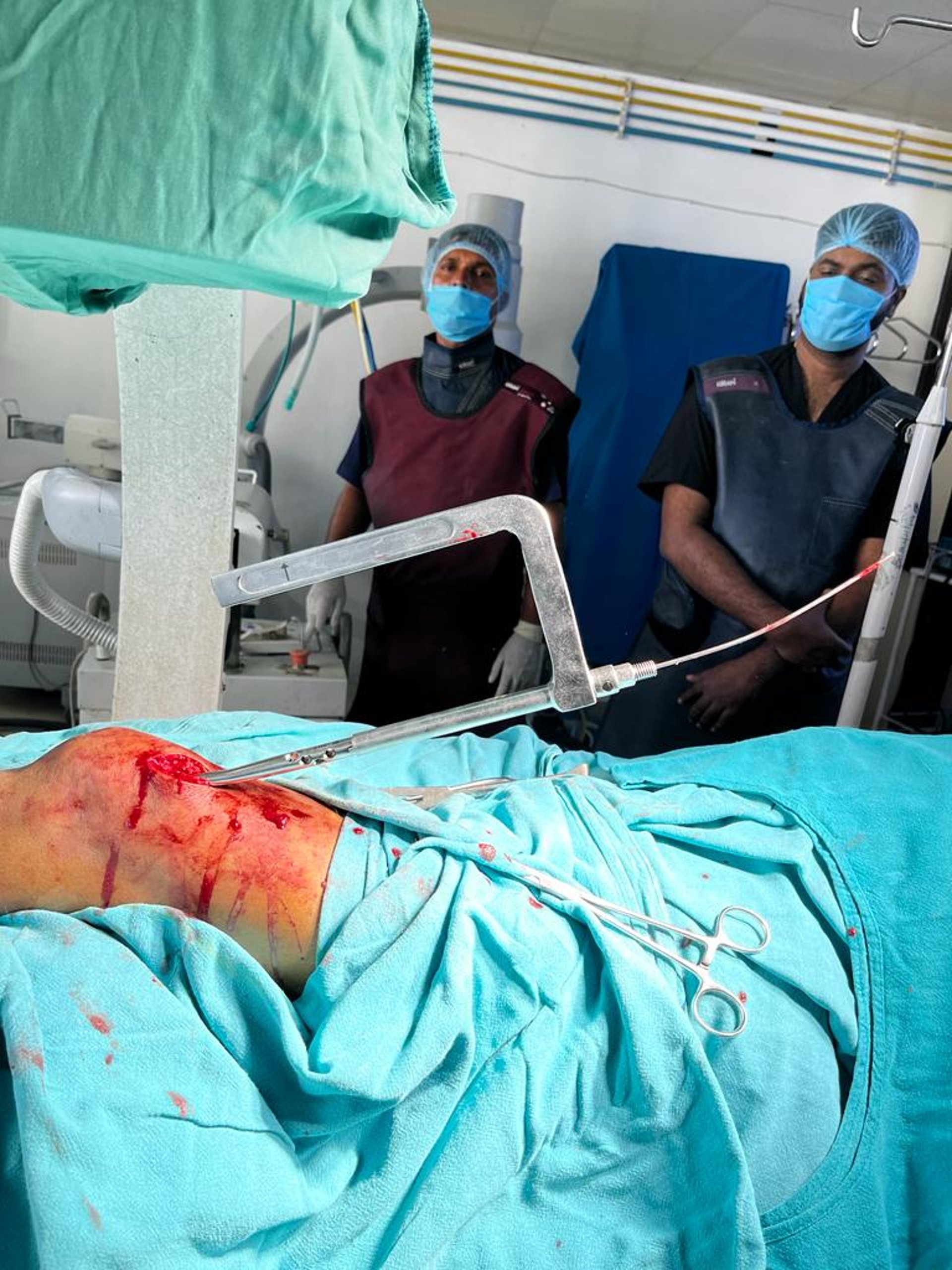 woman wearing yellow long-sleeved dress under white clouds and blue sky during daytime