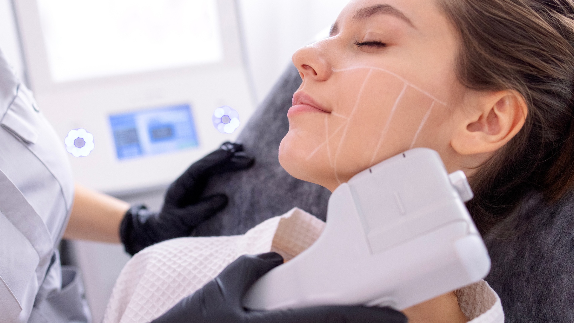 hifu treatment on woman's side jaw