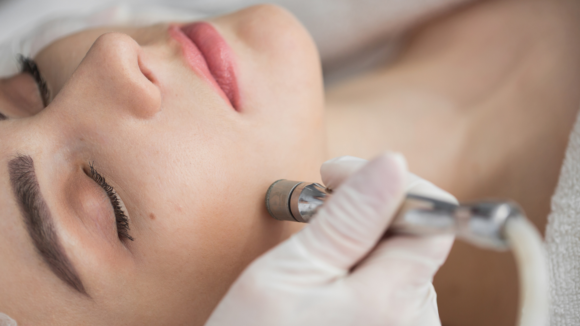 woman getting diamond tip microdermabrasion facial on her cheek