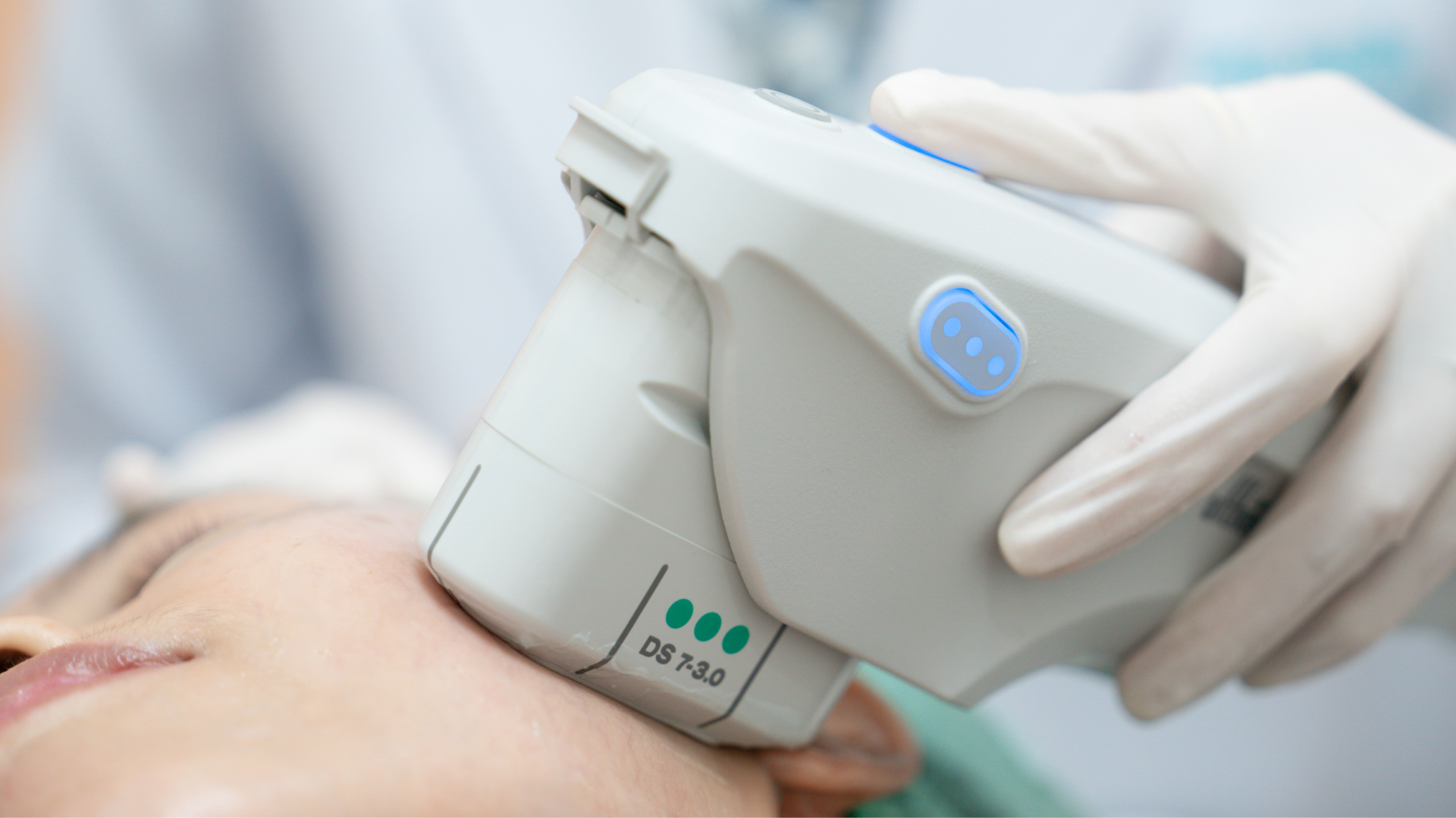 close up of ultherapy machine on client's cheek