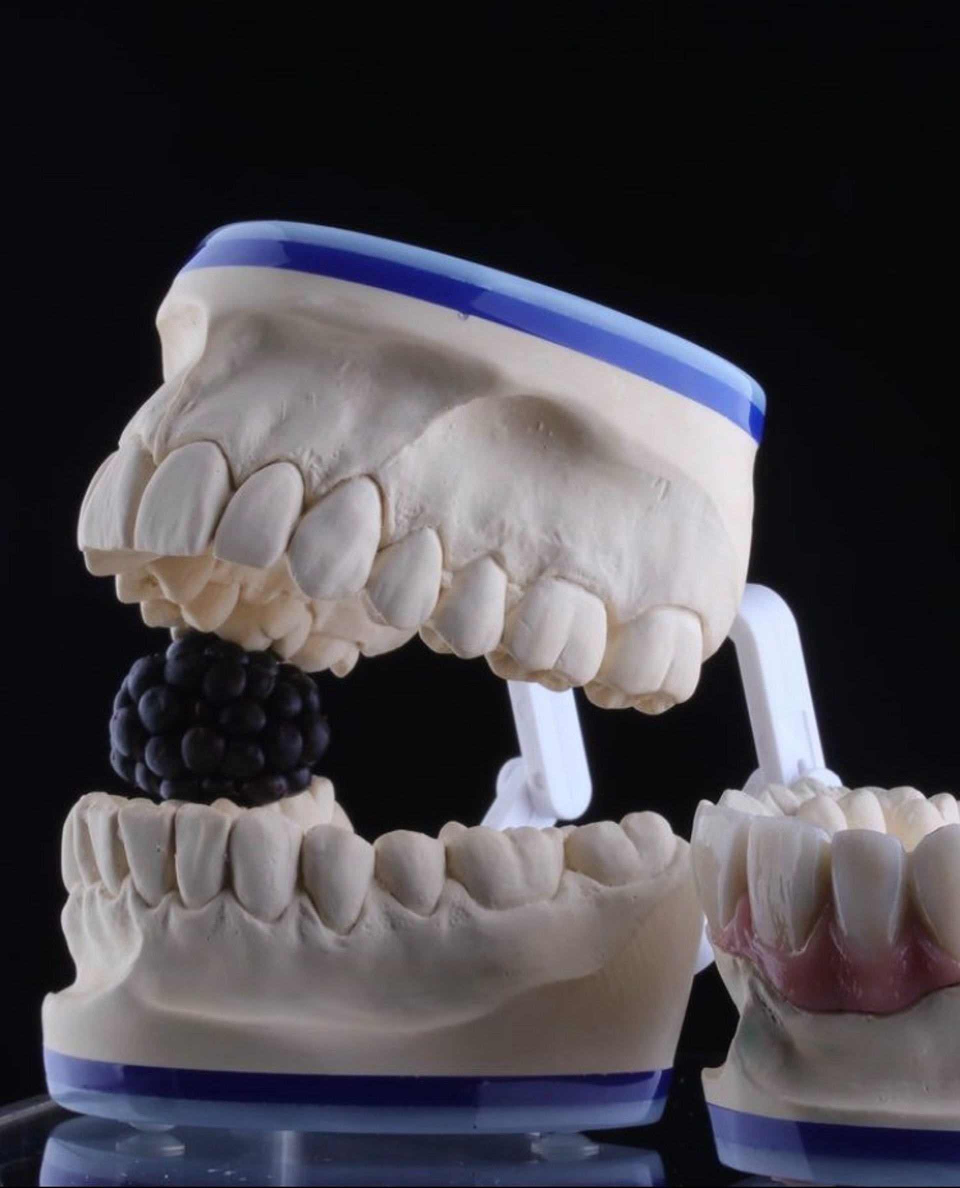 a close up of a tooth with gumpaste on it