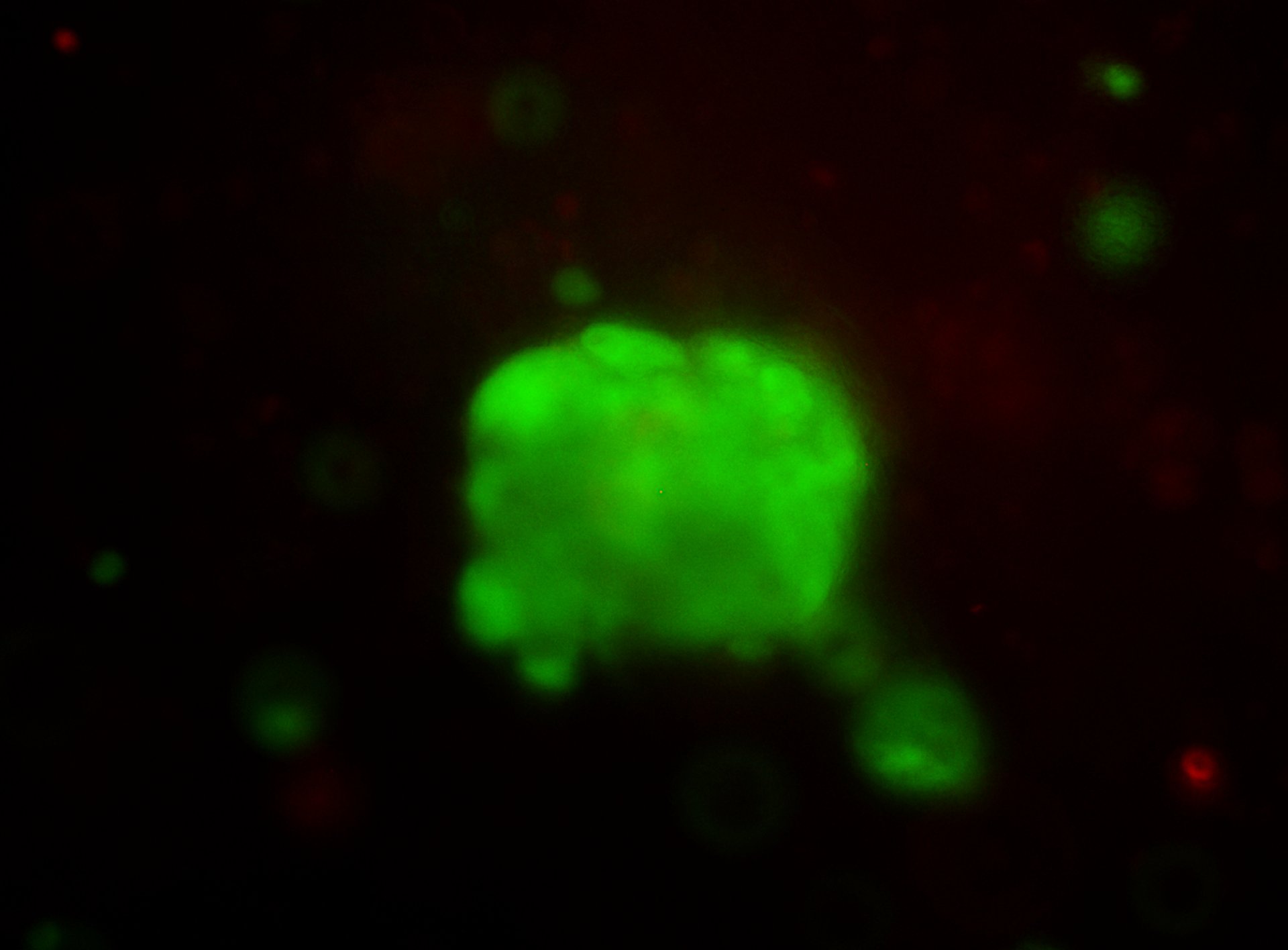 A human breast cancer cell organoid photographed by CTIBIOTECH.