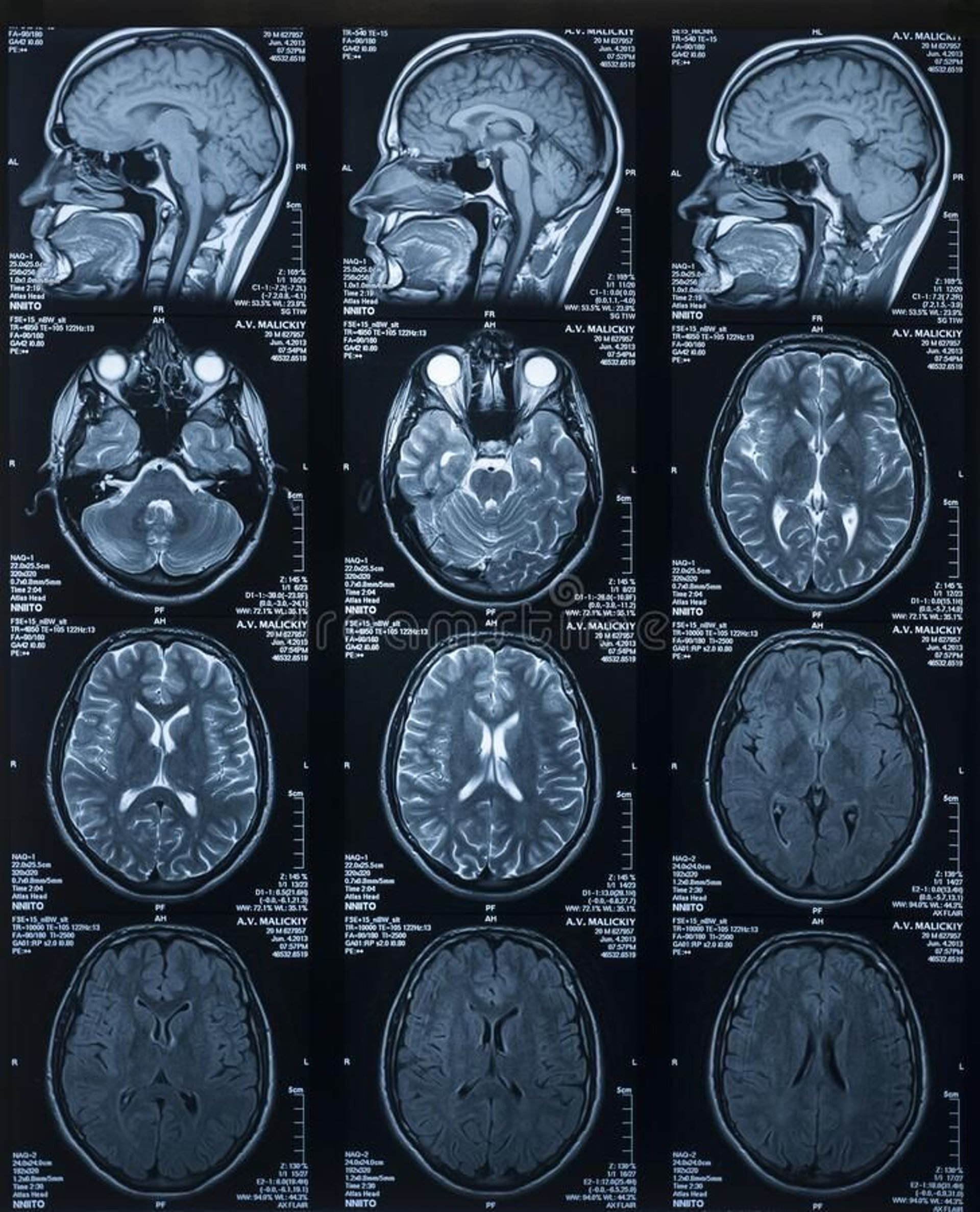 citiscan result hand ok
