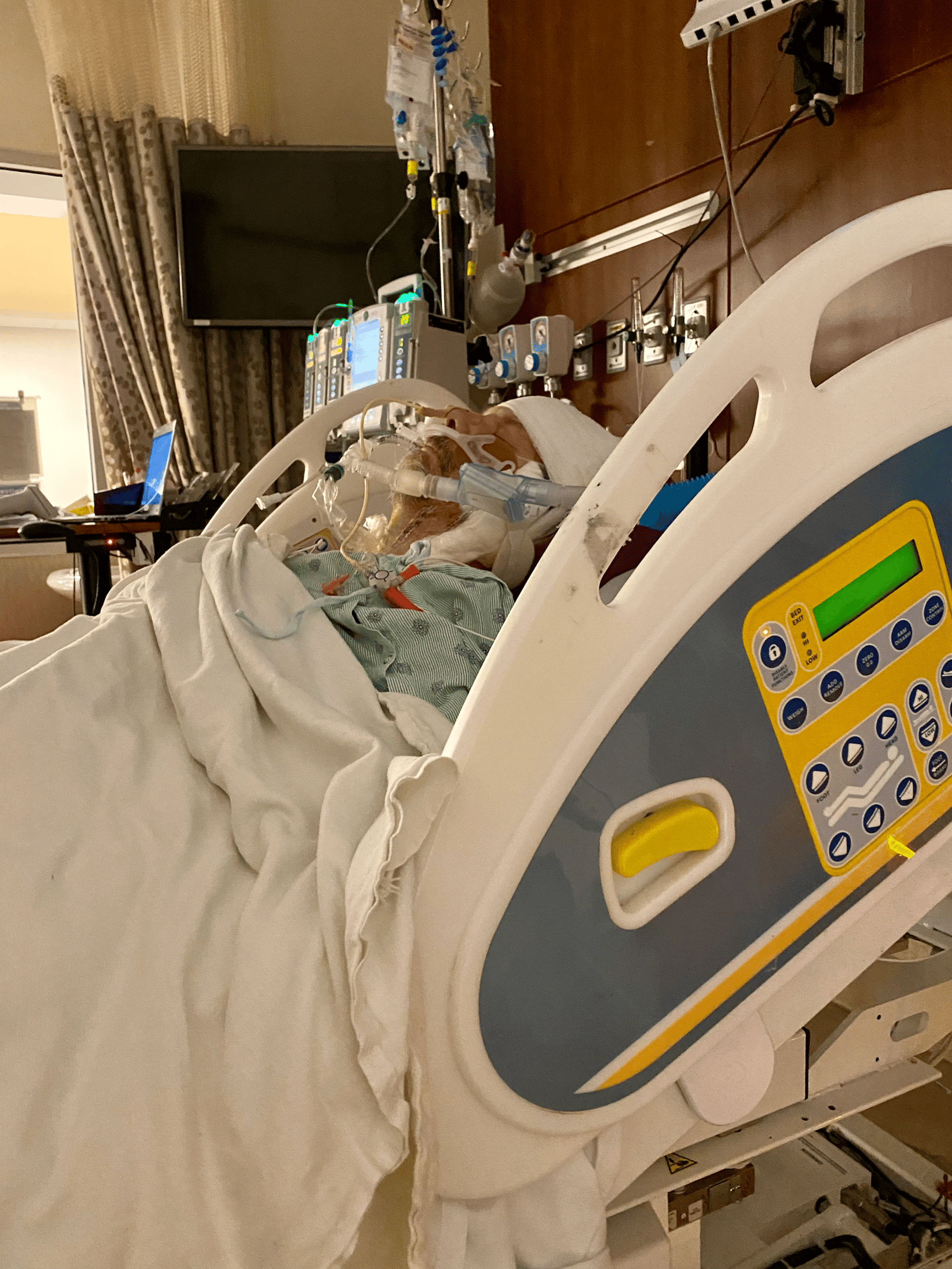 black and white bed linen